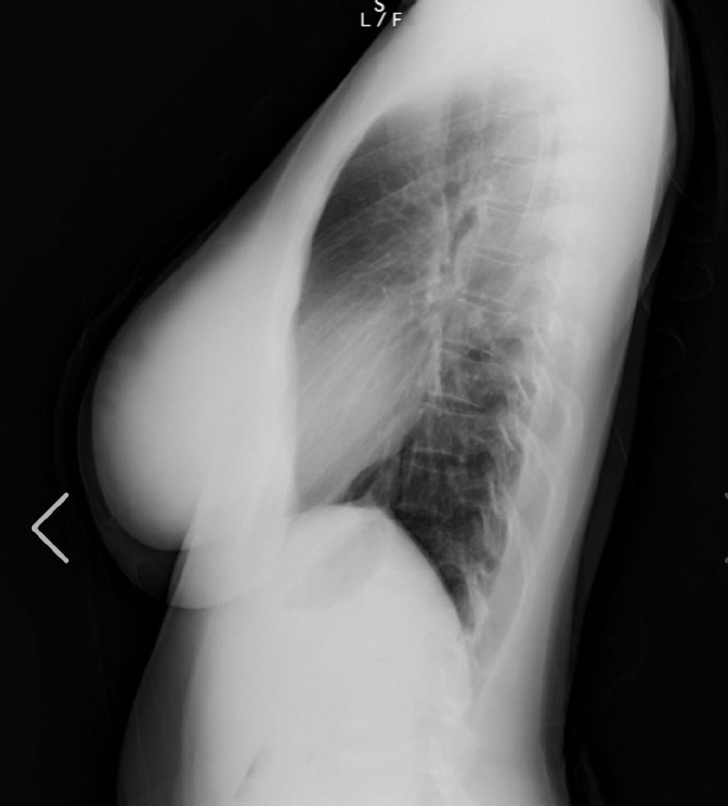 童颜巨乳偶像天木纯:经检查 我的大胸是天然的 附写真照